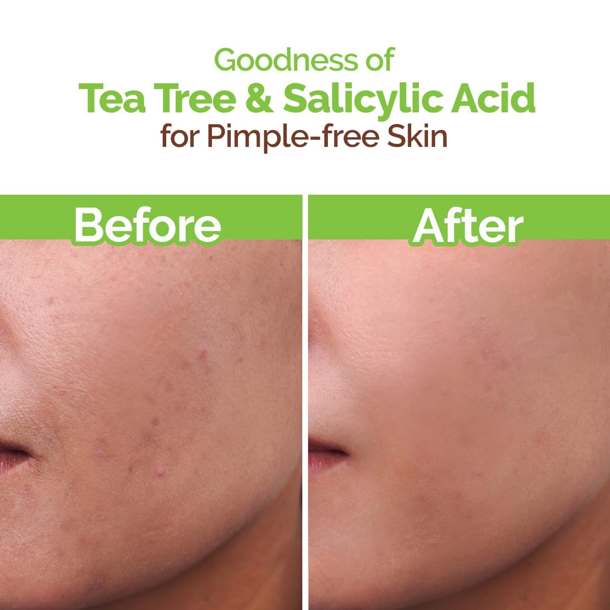 Mamaearth Tea Tree Pimple Control Face Wash with Tea Tree & Salicylic for Oily & Acne-Prone Skin - 100 ml | Controls Oil to Prevent Pimples | Crafted with tea tree & salicylic acid | Made Safe