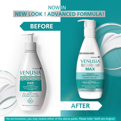 Dr. Reddy's Venusia Max Intensive Moisturizing Lotion for Normal to Dry skin |Body lotion I  , Cocoa Butter, Shea Butter, Aloe Butter, Mango Butter I Treats dry, dull, dehydrated skin I Non-comedogenic lotion for face & body I 300 g