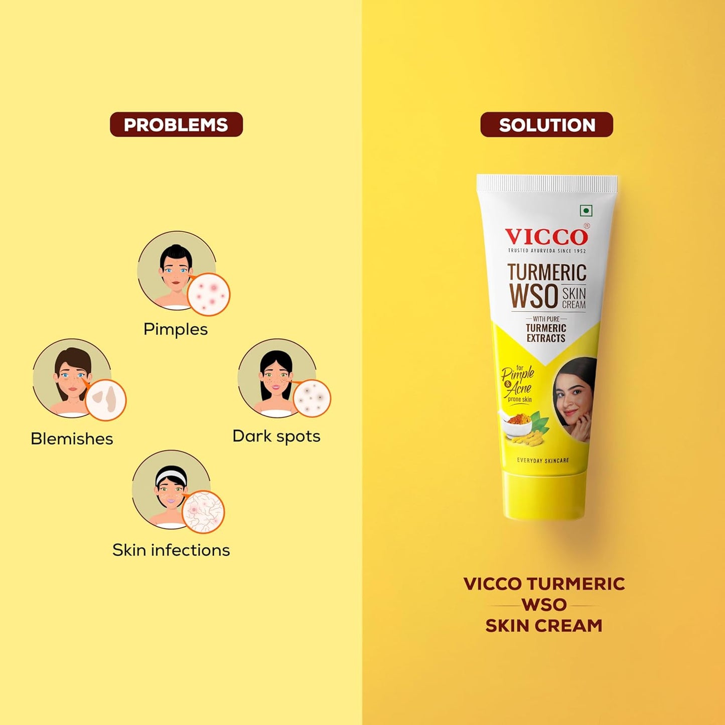 Vicco Turmeric WSO Cream | Ayurvedic Skin Care for Pimples, Dark Spots, , Healthy and Anti-Acne Skin  | Pack Of 1]