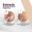 Blackhead Remover  1PCS